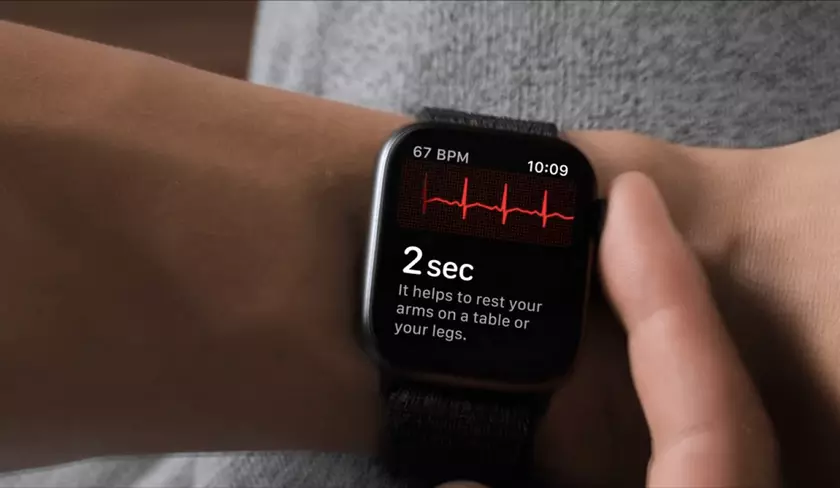 Пользователи Apple Watch в Украине с обновлением watchOS 7.6 получили поддержку ЭКГ