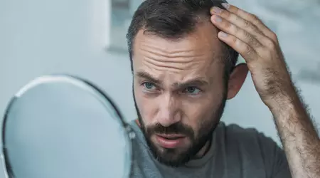 Scientists have discovered an unexpected property of DNA sugar that could solve hair loss in men and women