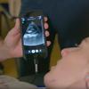 portable-ultrasound-butterfly-iq-6.jpg