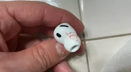 AirPods Pro 3 users complain of ear pain and bleeding