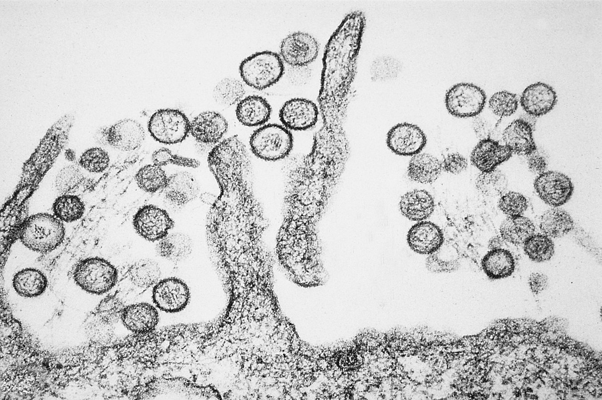 A look inside: a unique micrograph of hantavirus