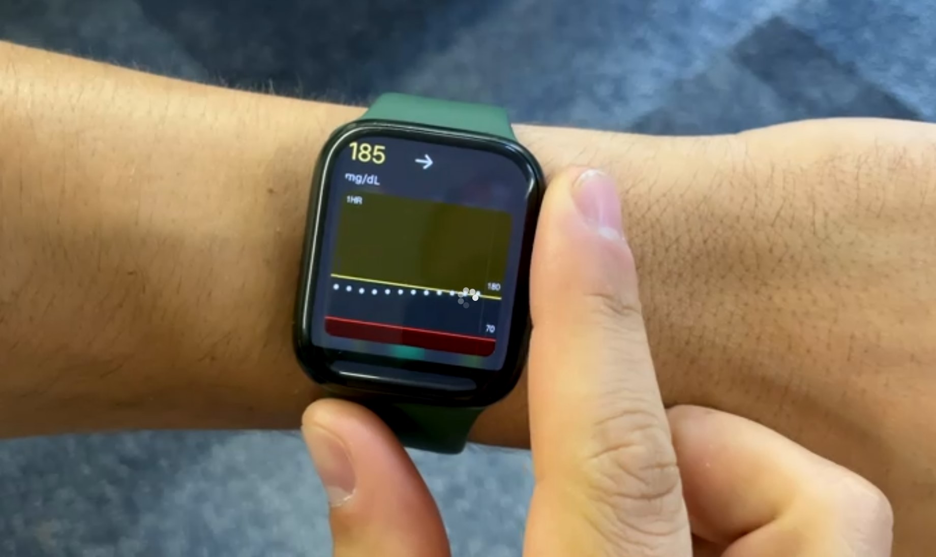 Le vidéaste de CNET et diabétique Justin Eastzer affirme que l'Apple Watch lui a sauvé la vie