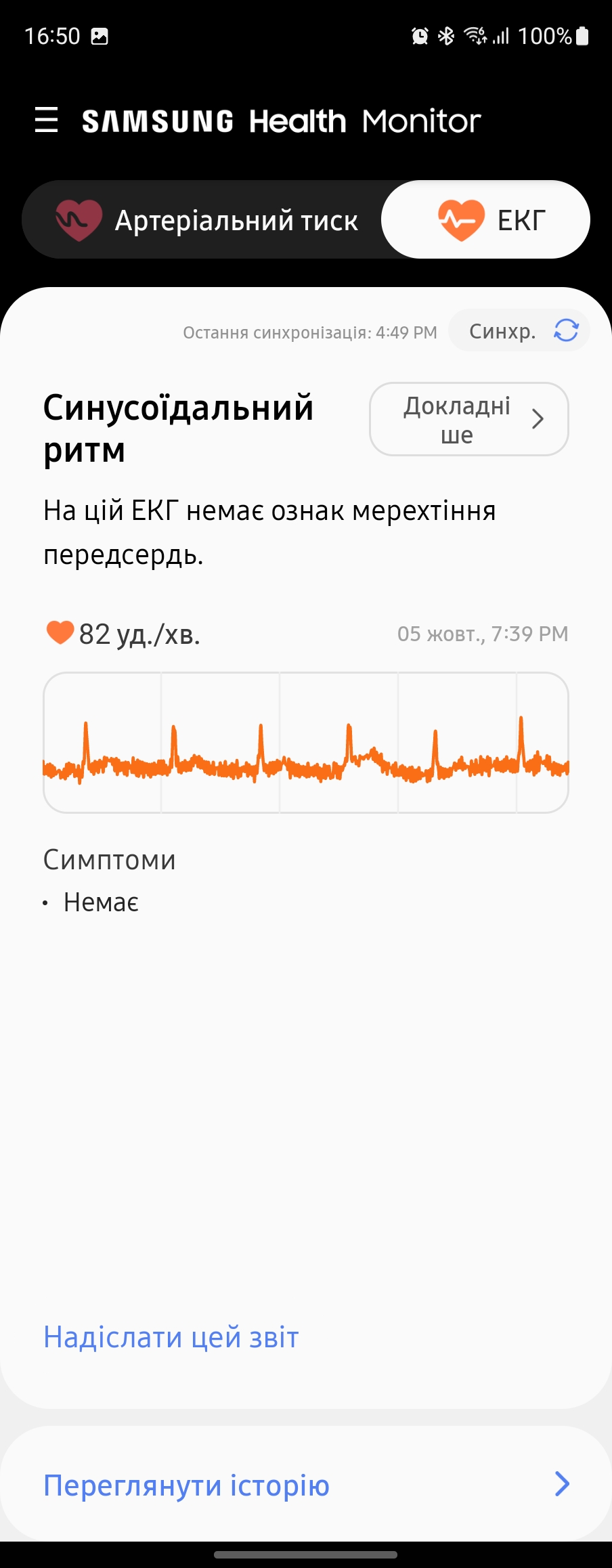 Огляд Samsung Galaxy Watch5 Pro та Watch5: плюс автономність, мінус фізичний безель-228