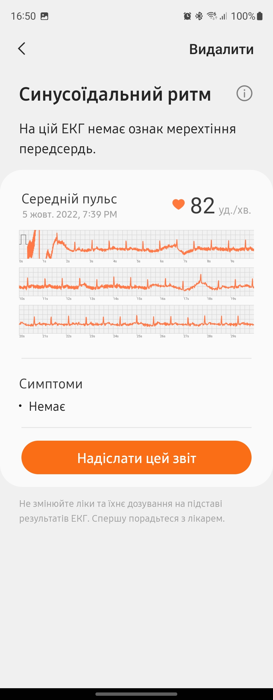 Огляд Samsung Galaxy Watch5 Pro та Watch5: плюс автономність, мінус фізичний безель-229