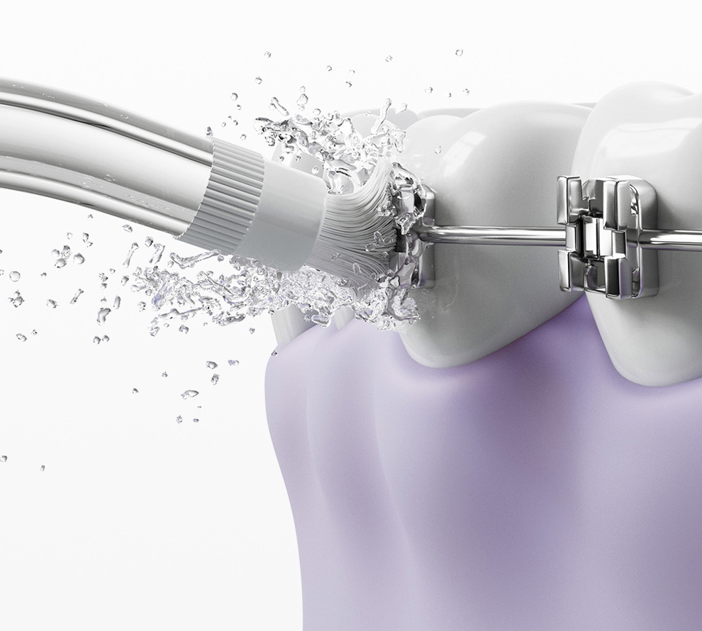 Xiaomi Mijia Smart Water Flosser Pro зображення 2